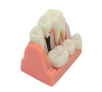 Modelo de dientes flexibles modelo de implante de dientes para estudiar, módulo de enseñanza para ciencias médicas, odontología, modelos para educación del paciente, estudiantes, enseñanza e