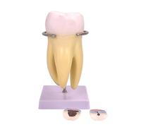 Modelo de dientes humanos modelo de anatomía de dientes molares para ajuste clínico y comunicación médico-paciente dientes estándar