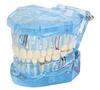 Modelo de dientes para enseñar a los niños, modelo de dientes confiable fácil de transportar con modelo de dientes desmontables para laboratorios para maestros para estudiantes para la Cuidado bucal Cuidado bucal