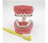 Modelo De Dientes Para Entrenamiento - Modelo De Ortodoncia - Modelo De Enseñanza De Dientes Con Soporte De Metal Y Cerámica - Modelo De Entrenamiento Correctivo De Dientes Para Niños Enseñanza De Cui