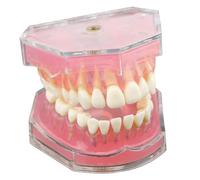 Modelo de dientes typodont, modelo de dientes de demostración dental estándar con diente extraíble, accesorios de asistente dental