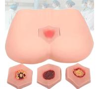 Modelo de enfermería con simulador de úlceras por presión, modelo de entrenamiento de úlceras por decúbito portátil, modelo de úlceras por presión de PVC, 4 etapas de úlceras por presión.