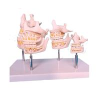 Modelo de enseñanza de anatomía dental, modelo de desarrollo de mandíbula y secuencia dental para niños para exhibición y educación de cuidado bucal