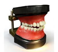Modelo de enseñanza de ortodoncia, modelo de maloclusión ortodóncica tipodonto con todos los dientes removibles, encía de cera roja. Modelos de práctica para demostración y capacitación educativa.