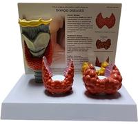 Modelo de enseñanza, Modelo de anatomía de la tiroides, Modelo de nódulo de tiroides, Modelo patológico de tiroides, Modelo anatómico de órgano Humano, Modelo de Enfermedad de Tiro