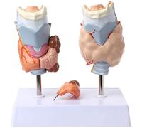 Modelo de enseñanza, Modelo de patología anatómica de la tiroides, Modelo de anatomía Humana, patologías Normales y patológicas, Herramienta de recursos de enseñanza médica, Anatom