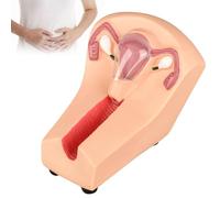 Modelo de entrenamiento anticonceptivo intrauterino para enfermería ginecológica, dispositivo de orientación de anticoncepción translúcida del útero