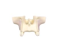 Modelo de entrenamiento for elevación seno maxilar. práctica implante dental realista con hueso simulado for demostración quirúrgica