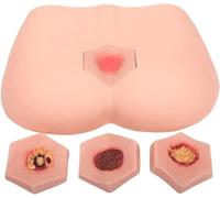 Modelo de entrenamiento para úlceras por decúbito, herramienta anatómica de demostración de úlceras para el cuidado de heridas y entrenamiento de enfermería