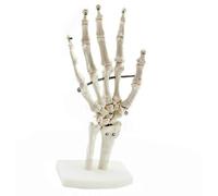 Modelo de esqueleto de mano humana, modelo ortopédico de articulación de la mano, comunicación médico-paciente ortopédica, huesos de la muñeca, huesos metacarpianos y falanges.