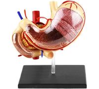 Modelo de estómago y páncreas humanos, modelo de anatomía gástrica, modelos de órganos digestivos humanos 1:1, herramienta de enseñanza de anatomía de patología del estómago, for aprendizaje