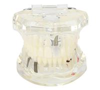 Modelo de estudio de implantes dentales, herramienta transparente de visualización de la estructura dental para demostración educativa e