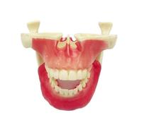 Modelo de estudio de implantes maxilares: herramienta didáctica for la práctica odontológica en la formación sobre elevación de seno maxilar y fijación con clavos.