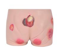 Modelo De Formación Para Úlceras Por Presión En Personas Mayores, Modelo De Herida Por Úlcera Por Presión, Múltiples Heridas Por Úlcera Simuladas, Modelo Enfermería Para Simulador Úlceras Por Presión