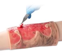 Modelo de herida por quemadura, simulador de quemaduras de extremidades de silicona portátil, módulo de entrenamiento de quemaduras de extremidades de 2-3 grados for atención, demostración