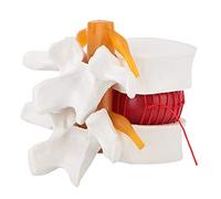 Modelo de Hernia de Disco Lumbar Humano, 1: 1.5 Modelo AnatóMico Humano de DemostracióN de Columna Vertebral Lumbar, Lumbar Humano del Modelo de Columna Vertebral Lumbar para Demostración Médica