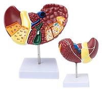 Modelo de hígado Humano, con Base y Textura Clara y características patológicas para Estudios e investigaciones en la facultad de Medicina