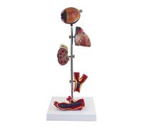 Modelo De Hipertensión Humana, Trombosis Cardiovascular, Hipertensión, Daño A Órganos Humanos, Corazón, Vasos Sanguíneos