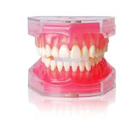 Modelo de implante dental con dientes de resina extraíbles y encía blanda para cirujanos orales y estudiantes de odontología.