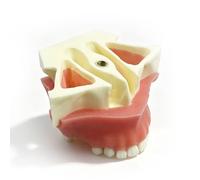 Modelo de implante dental maxilar, modelo de práctica de elevación de seno maxilar con implante dental, modelos de dientes tipodontos para capacitación, enseñanza, demostración y estudio.