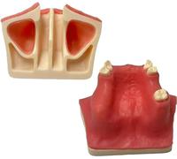 Modelo De Implante Ejercicio De Elevación Del Seno Maxilar Encías Blandas Modelo De Práctica De Elevación Del Seno Maxilar - Modelo De Práctica De Implante Dental - Implante De Simulación