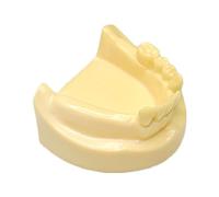 Modelo De Implante Mandibular - Modelo Dental De Práctica De Implantes Orales - Modelo De Dientes para Educación - Modelo De Dientes De Sobredentadura Mandibular - para Enseñanza De Estudio