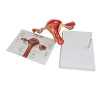 Modelo de lesión uterina Modelo de útero patológico humano Modelo de ovario Modelo de útero-ovario Órganos reproductores femeninos
