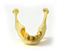 Modelo de mandíbula dental para práctica de perforación e inserción de implantes, mandíbula simple para práctica de perforación, excelente diente de entrenamiento