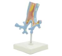 Modelo de órgano Humano Modelo de anatomía del árbol bronquial Humano Modelo bronquial patológico Modelo didáctico Colorido como Ayuda didáctica Visual for el Estudio Escolar