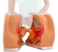 Modelo de orientación anticonceptiva ginecológica, modelo de entrenamiento del DIU, visualización de la estructura del ovario de la vagina del útero cervical, for la enseñanza de fisiología