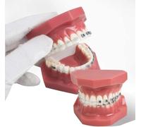 Modelo de ortodoncia dental Modelo de dientes con soportes de metal y cerámica Modelos de demostración oral for la enseñanza de odontología o la comunicación del dentista.