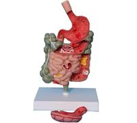 Modelo de patología del intestino grueso, modelo anatómico del estómago humano, sección del estómago, modelo médico anatómico del intestino delgado grueso.