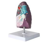 Modelo de pulmón de Humo, Modelo anatómico de pulmón Humano 2: 3 con características patológicas para Modelos de enseñanza comunicación médico-Paciente