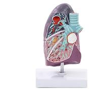 Modelo de pulmón de patología, Modelo anatómico de pulmón Humano 3D con Estructura de anatomía precisa para Modelos de enseñanza comunicación médico-Paciente
