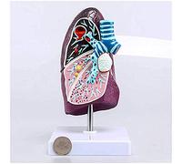 Modelo de pulmón humano - Modelo anatómico de pulmón enfermo 2:3 genuino, tamaño real, modelos de enseñanza para aula de ciencias y estudio médico, comunicación con pacientes