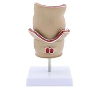 Modelo de recto humano para anatomía, ayuda didáctica práctica de patologías humanas del recto, material escolar, patologías de medicina, enseñanza