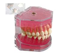 Modelo De Relleno Dental para La EnseñAnza: RéPlica De Resina Simulada A Escala 1:1 del Modelo Dental para Demostraciones De EnseñAnza Dental.