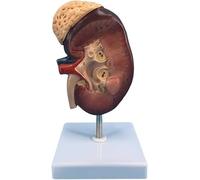 Modelo de riñón humano: ayuda didáctica anatómica con aumento de 2X, estructura precisa y etiquetas digitales.