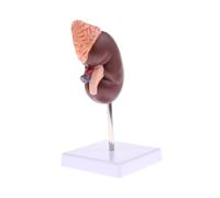 Modelo de Riñón Humano, Enseñanza Anatómica, Herramienta Educativa para el Consultorio del Médico, 2 Partes, Sección Sagital Media, Muestra Estructuras Internas Utilizadas