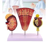 Modelo de riñón, modelo de anatomía de nefrona renal humana y glomérulo para educación médica y disección asistida