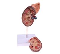 Modelo de riñón NSXAYIWE, Modelo de anatomía renal Humana con Base, Dividida en 2 Partes Que Muestran una Estructura Interna una réplica Normal de anatomía Humana de riñón para la