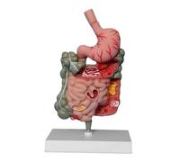 Modelo de sistema digestivo humano, pantalla de anatomía de PVC con estómago, intestino, duodeno recto para demostración en el aula de 6.3 x 4.3 x 2.1 pulgadas