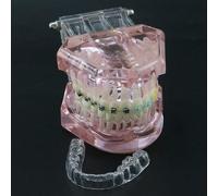 Modelo de Soportes de ortodoncia Dental,Modelo de demostración de retenedor de ortodoncia de Dientes dentales con Soporte de autoligado de cerámica metálica para Entrenamiento con ligadura