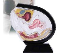 Modelo de útero, Modelo de Anatomía Uterina Transparente Femenina, Modelo de Enseñanza del Recto de La Cavidad Pélvica para Formación Educativa Médica