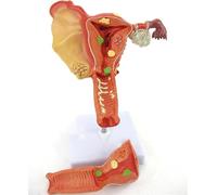 Modelo de útero y ovario humano, modelo de órgano de trompa de Falopio de ovario de cuello uterino reproductivo extraíble, modelo de anatomía patológica uterina de tamaño natural, for estudio