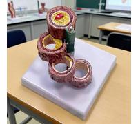 Modelo De Vasos Sanguíneos De Arteria Humana De 4 Etapas, Modelo De Aterosclerosis Con Acumulación De Placa, Modelo De Anatomía Vascular Enferma, Diseño Giratorio, Para Educación En Fisiología
