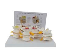 Modelo de Vértebras Lumbares de 4 Etapas con Tarjeta Posterior en Inglés, Columna Lumbar Humana Desmontable, Material de PVC, Herramienta Didáctica para Herramienta Didáctica