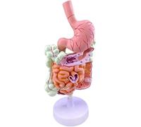 Modelo del sistema digestivo humano con estómago extraíble, anatomía del estómago, intestino grueso, ciego, recto y duodeno, modelo de anatomía humana del tracto gastrointestinal con patologías