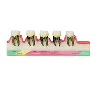 Modelo Dental, Construcción Transparente De Cerámica, Modelo De Exhibición Oral, Modelo De Dientes, Modelos Periodontales Para Enseñanza Y Práctica