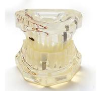 Modelo dental de reparación neural, modelo educativo de dientes extraíbles anatómicos para la escuela de odontología, fantoma dental material didáctico de demostración